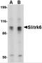 SLIT And NTRK Like Family Member 6 antibody, 4479, ProSci, Western Blot image 