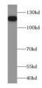 Family With Sequence Similarity 186 Member B antibody, FNab02976, FineTest, Western Blot image 