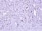 Zinc Finger CCCH-Type Containing 8 antibody, NBP1-32522, Novus Biologicals, Immunohistochemistry paraffin image 