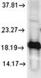 Superoxide Dismutase 1 antibody, orb67512, Biorbyt, Western Blot image 