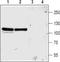Glutamate Ionotropic Receptor NMDA Type Subunit 3A antibody, TA328843, Origene, Western Blot image 