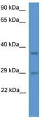 Mediator Complex Subunit 19 antibody, TA330945, Origene, Western Blot image 