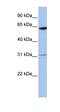 LOC642141 antibody, orb325463, Biorbyt, Western Blot image 