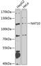 N-Acetyltransferase 10 antibody, 22-840, ProSci, Western Blot image 