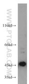 MAGE Family Member A1 antibody, 55105-1-AP, Proteintech Group, Western Blot image 