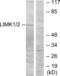 LIM domain kinase 1 antibody, LS-C199199, Lifespan Biosciences, Western Blot image 