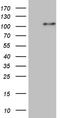 Histone-lysine N-methyltransferase NSD3 antibody, TA809975S, Origene, Western Blot image 