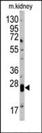 Claudin 1 antibody, AP13331PU-N, Origene, Western Blot image 