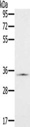 NADH:Ubiquinone Oxidoreductase Subunit A9 antibody, CSB-PA289822, Cusabio, Western Blot image 
