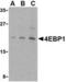 Eukaryotic Translation Initiation Factor 4E Binding Protein 1 antibody, AHP993, Bio-Rad (formerly AbD Serotec) , Western Blot image 