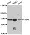 Complement Component 4 Binding Protein Alpha antibody, A7648, ABclonal Technology, Western Blot image 