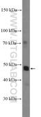 Nuclear Receptor Subfamily 1 Group H Member 4 antibody, 25055-1-AP, Proteintech Group, Western Blot image 
