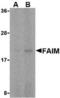 Fas apoptotic inhibitory molecule 1 antibody, TA306048, Origene, Western Blot image 