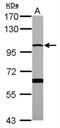 Membrane Metalloendopeptidase antibody, NBP2-15771, Novus Biologicals, Western Blot image 