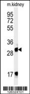 F-Box And Leucine Rich Repeat Protein 15 antibody, 61-839, ProSci, Western Blot image 