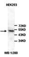 SMAD Family Member 1 antibody, orb77385, Biorbyt, Western Blot image 