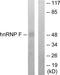 Heterogeneous Nuclear Ribonucleoprotein F antibody, TA312177, Origene, Western Blot image 