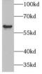 Paired Box 3 antibody, FNab06169, FineTest, Western Blot image 