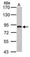 HNF1 Homeobox A antibody, TA308567, Origene, Western Blot image 