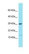 Family With Sequence Similarity 177 Member B antibody, orb326989, Biorbyt, Western Blot image 