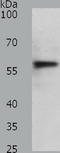 ATP Binding Cassette Subfamily D Member 4 antibody, TA322673, Origene, Western Blot image 