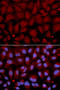 Butyrylcholinesterase antibody, A00258-1, Boster Biological Technology, Western Blot image 
