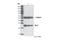 BCL2 antibody, 2870S, Cell Signaling Technology, Western Blot image 