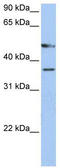 Forkhead Box D4 antibody, TA342519, Origene, Western Blot image 