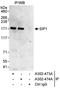 Zinc Finger E-Box Binding Homeobox 2 antibody, A302-473A, Bethyl Labs, Immunoprecipitation image 