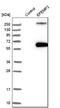 EGF Containing Fibulin Extracellular Matrix Protein 2 antibody, NBP1-84724, Novus Biologicals, Western Blot image 