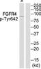Fibroblast Growth Factor Receptor 4 antibody, TA311938, Origene, Western Blot image 
