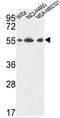 ATP Synthase F1 Subunit Alpha antibody, AP50297PU-N, Origene, Western Blot image 