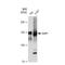 Inositol Polyphosphate-5-Phosphatase D antibody, GTX03199, GeneTex, Western Blot image 