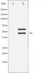 Calcium/Calmodulin Dependent Protein Kinase II Beta antibody, TA325289, Origene, Western Blot image 