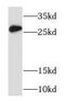 RAB33A, Member RAS Oncogene Family antibody, FNab07017, FineTest, Western Blot image 