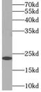 Myosin light chain 3 antibody, FNab09860, FineTest, Western Blot image 