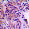 Nuclear Receptor Subfamily 3 Group C Member 1 antibody, LS-C356236, Lifespan Biosciences, Immunohistochemistry paraffin image 