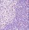 Bruton Tyrosine Kinase antibody, LS-C156886, Lifespan Biosciences, Immunohistochemistry frozen image 