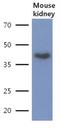 LDL Receptor Related Protein Associated Protein 1 antibody, NBP2-42682, Novus Biologicals, Western Blot image 