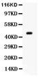 Aurora Kinase A antibody, PA1785, Boster Biological Technology, Western Blot image 