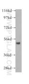 Tubulointerstitial Nephritis Antigen Like 1 antibody, 12077-1-AP, Proteintech Group, Western Blot image 