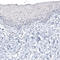 Cancer/Testis Antigen 83 antibody, AMAb91318, Atlas Antibodies, Immunohistochemistry frozen image 