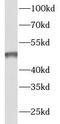 Lactamase Beta antibody, FNab04672, FineTest, Western Blot image 