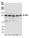 EWS RNA Binding Protein 1 antibody, A300-417A, Bethyl Labs, Western Blot image 