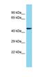 Family With Sequence Similarity 222 Member A antibody, orb326837, Biorbyt, Western Blot image 