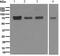 Protein Kinase C Epsilon antibody, ab124806, Abcam, Western Blot image 