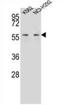 Membrane Palmitoylated Protein 3 antibody, AP52739PU-N, Origene, Western Blot image 