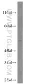 Cardiolipin Synthase 1 antibody, 51055-1-AP, Proteintech Group, Western Blot image 