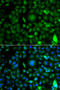 Zinc finger protein neuro-d4 antibody, STJ29488, St John