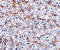 TNF Receptor Superfamily Member 12A antibody, 3951, ProSci Inc, Immunohistochemistry paraffin image 